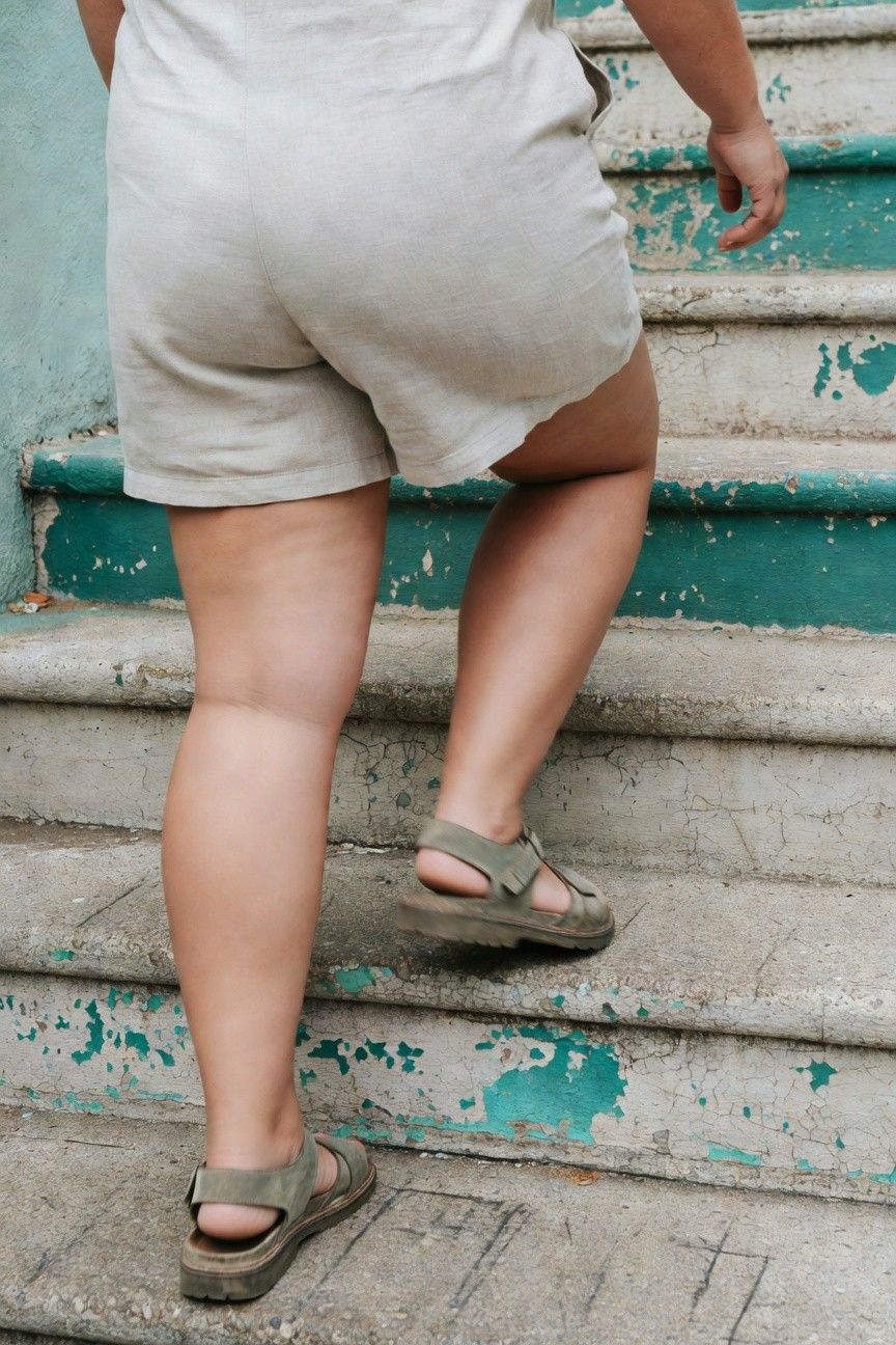 Rear view of plus-size woman ascending weathered stairs in a light beige linen romper with shorts length and green strap sandals, emphasizing casual summer comfort